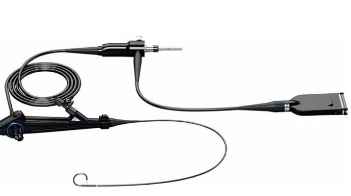 How Long Is Uniation Painful After Ureteroscope How Long Is Uniation Painful After Ureteroscope