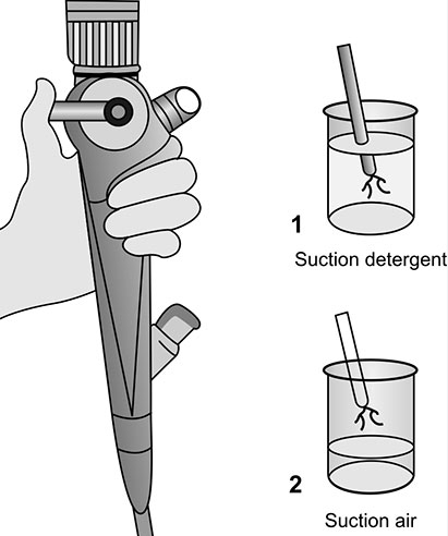 Bronchoscope Decontamination Steps