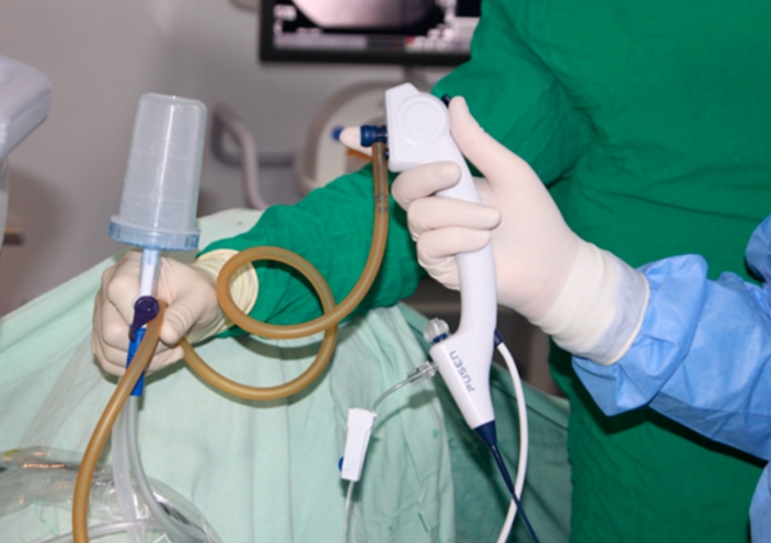 Semirigid Ureteroscope Procedure Guide