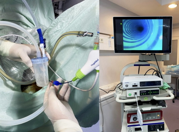 Top Disposable Ureteroscope Manufacturers and Suppliers in Spain