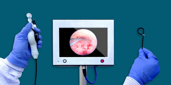 Single-Use Flexible Ureteroscope Manufacturers Single-Use Flexible Ureteroscope Manufacturers