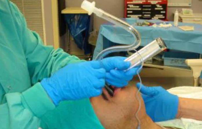 How To Insert Laryngoscope?
