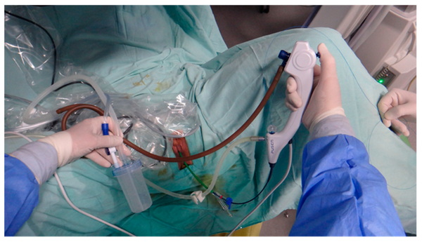 Top Disposable Ureteroscope Manufacturers and Suppliers in France
